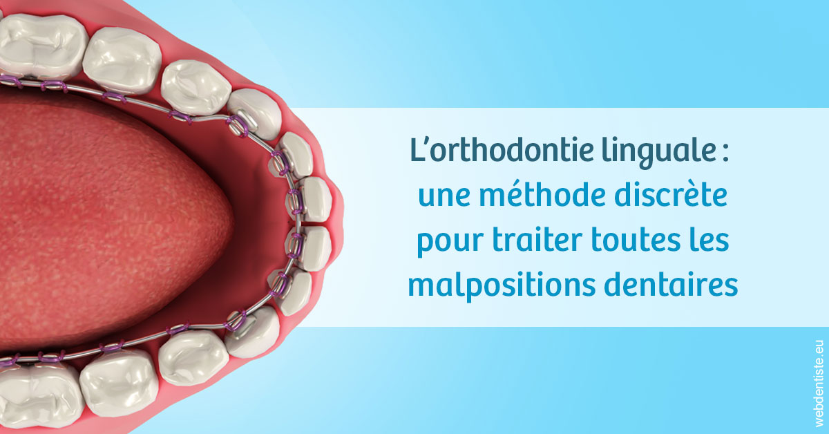 https://selarl-dr-nathan-michele.chirurgiens-dentistes.fr/L'orthodontie linguale 1