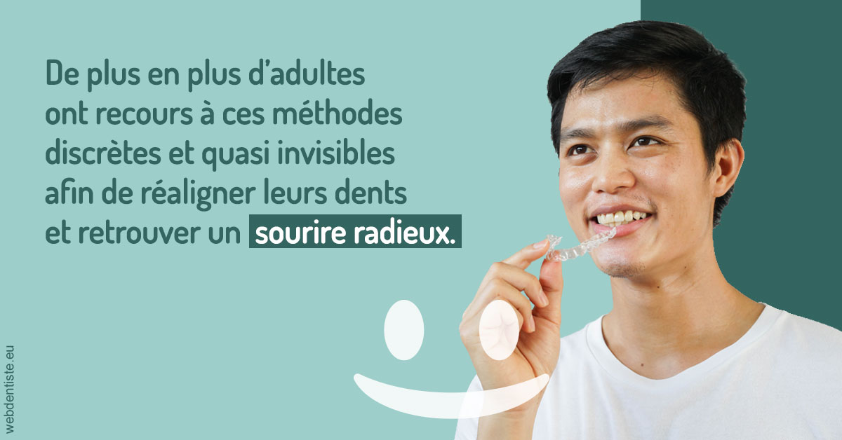 https://selarl-dr-nathan-michele.chirurgiens-dentistes.fr/Gouttières sourire radieux 2