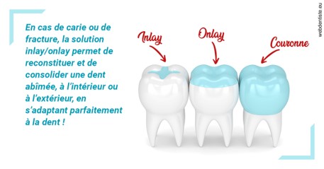 https://selarl-dr-nathan-michele.chirurgiens-dentistes.fr/L'INLAY ou l'ONLAY