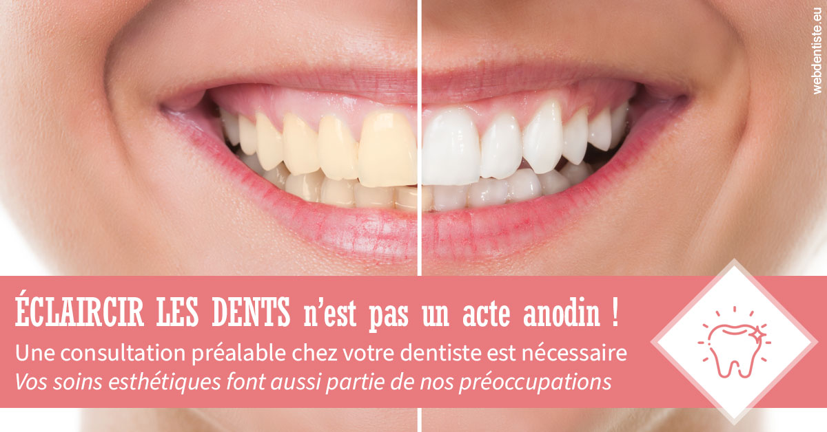 https://selarl-dr-nathan-michele.chirurgiens-dentistes.fr/Eclaircir les dents 1