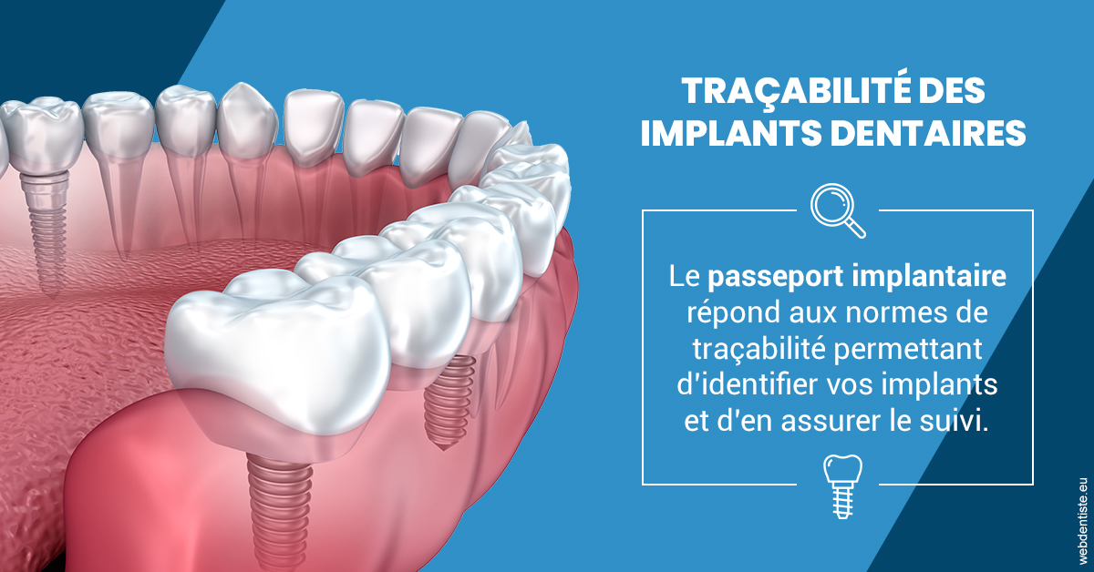 https://selarl-dr-nathan-michele.chirurgiens-dentistes.fr/T2 2023 - Traçabilité des implants 1