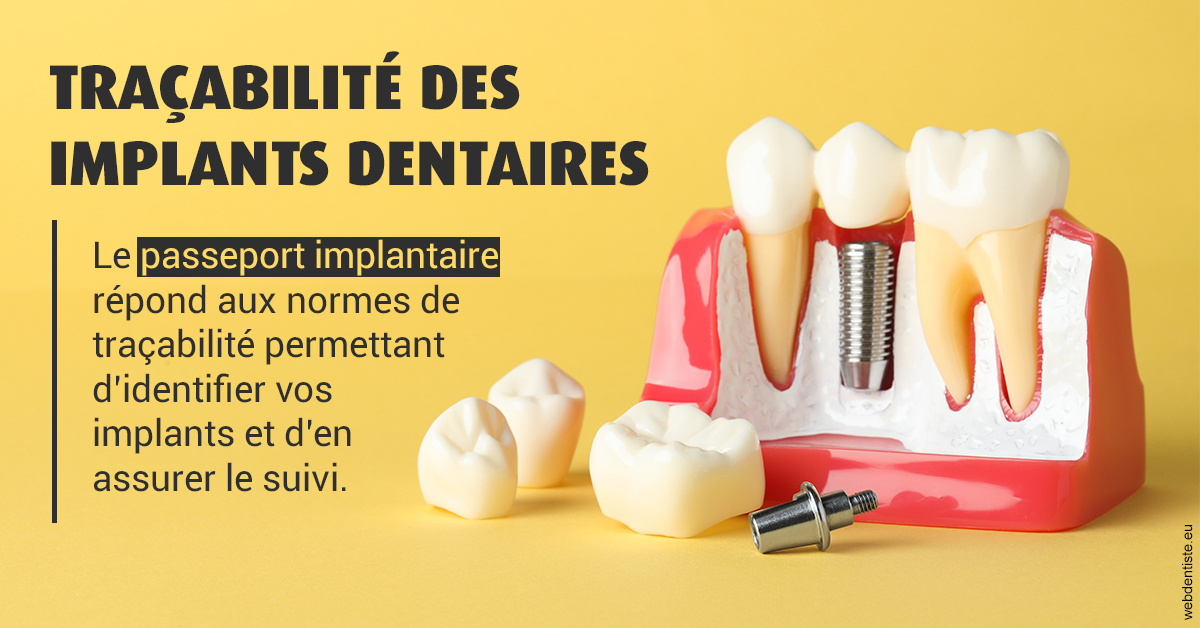 https://selarl-dr-nathan-michele.chirurgiens-dentistes.fr/T2 2023 - Traçabilité des implants 2