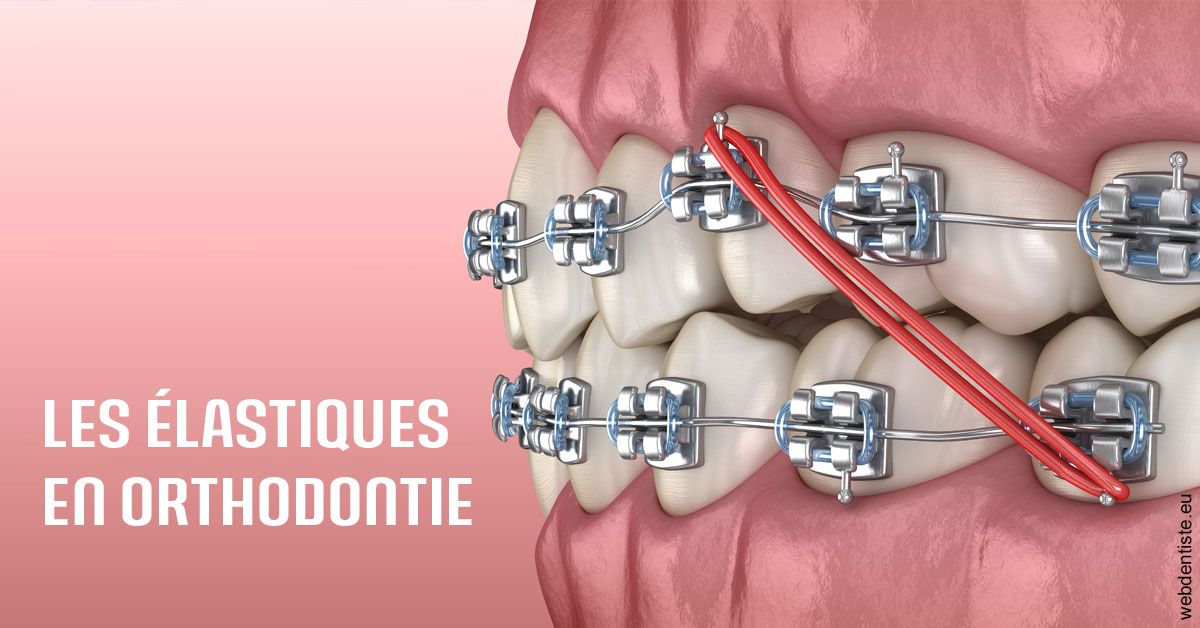 https://selarl-dr-nathan-michele.chirurgiens-dentistes.fr/Elastiques orthodontie 2