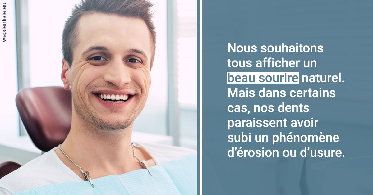 https://selarl-dr-nathan-michele.chirurgiens-dentistes.fr/Érosion et usure dentaire