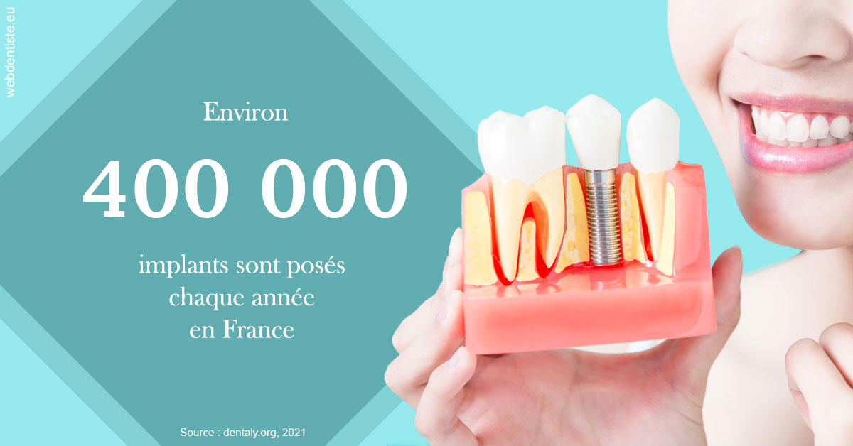 https://selarl-dr-nathan-michele.chirurgiens-dentistes.fr/Pose d'implants en France 2