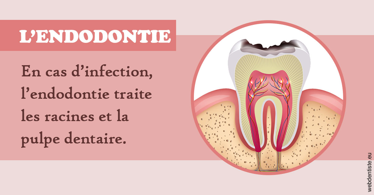 https://selarl-dr-nathan-michele.chirurgiens-dentistes.fr/L'endodontie 2